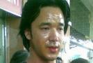 ช็อก! แดน ดนัย โดนแฟนเก่าสาดน้ำกรด